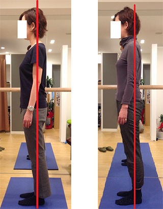 肩・首の痛みとコリが全身調整の自力整体で回復！E.Y様